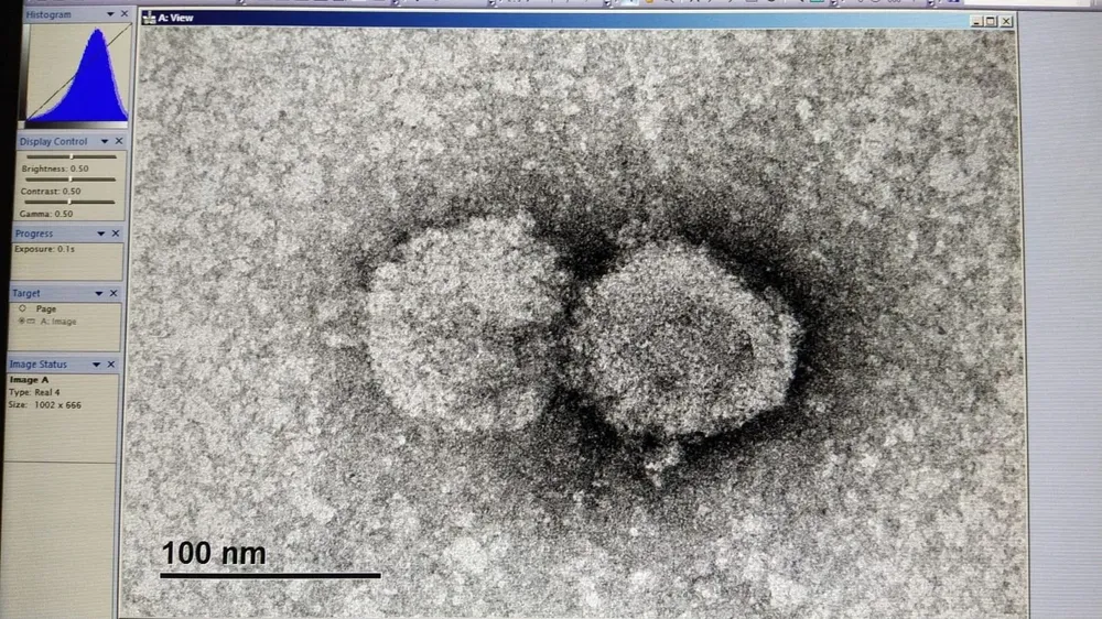 Imagen del coronavirus tomada en Uruguay