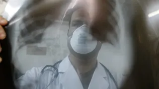 DGI detectó indicios de evasión en aportes de médicos por IRPF