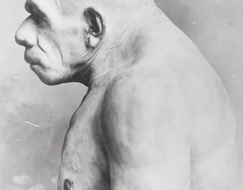 Impresión de un hombre neandertal