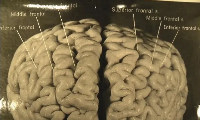 El cerebro de Einstein tenía una estructura distinta