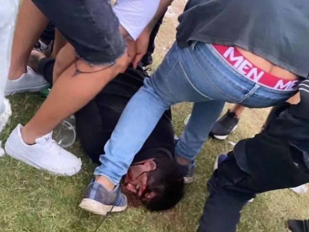 Herido en la cabeza quedó inconsciente.