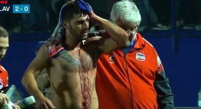 Así terminó un jugador de Lavalleja tras el título de San José por la Copa Nacional de Selecciones de OFI