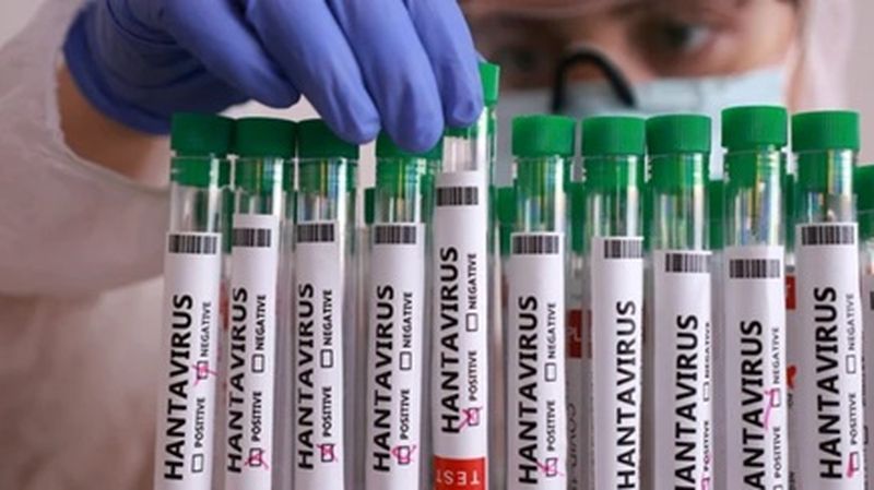 De una gripe común al shock respiratorio: cómo evoluciona el hantavirus Andes en el cuerpo