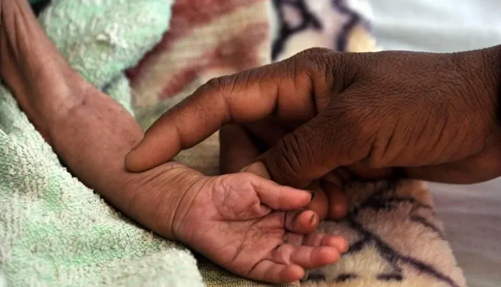 Mujer sostiene la mano de un niño yemení con malnutrición, en Saná