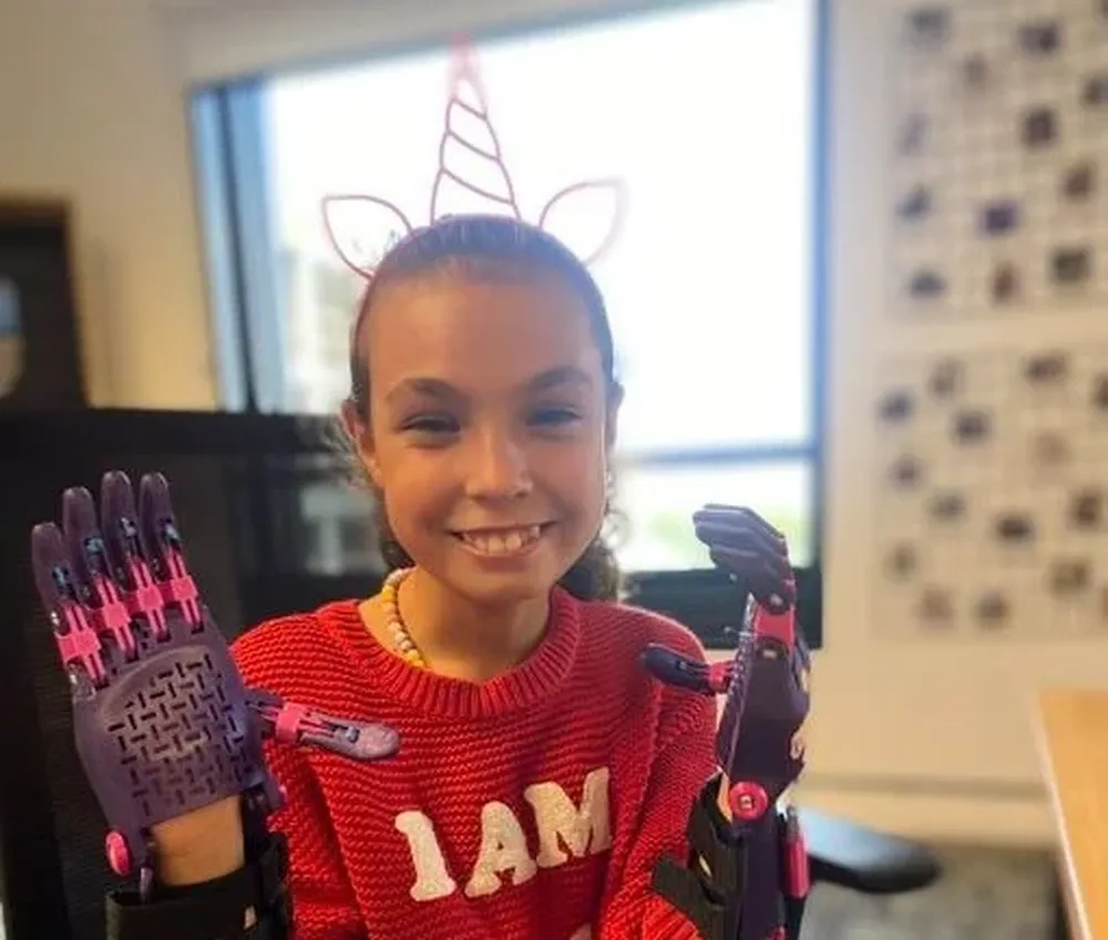 Mía con sus prótesis