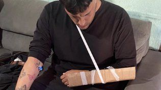 Fractura de un joven en San José