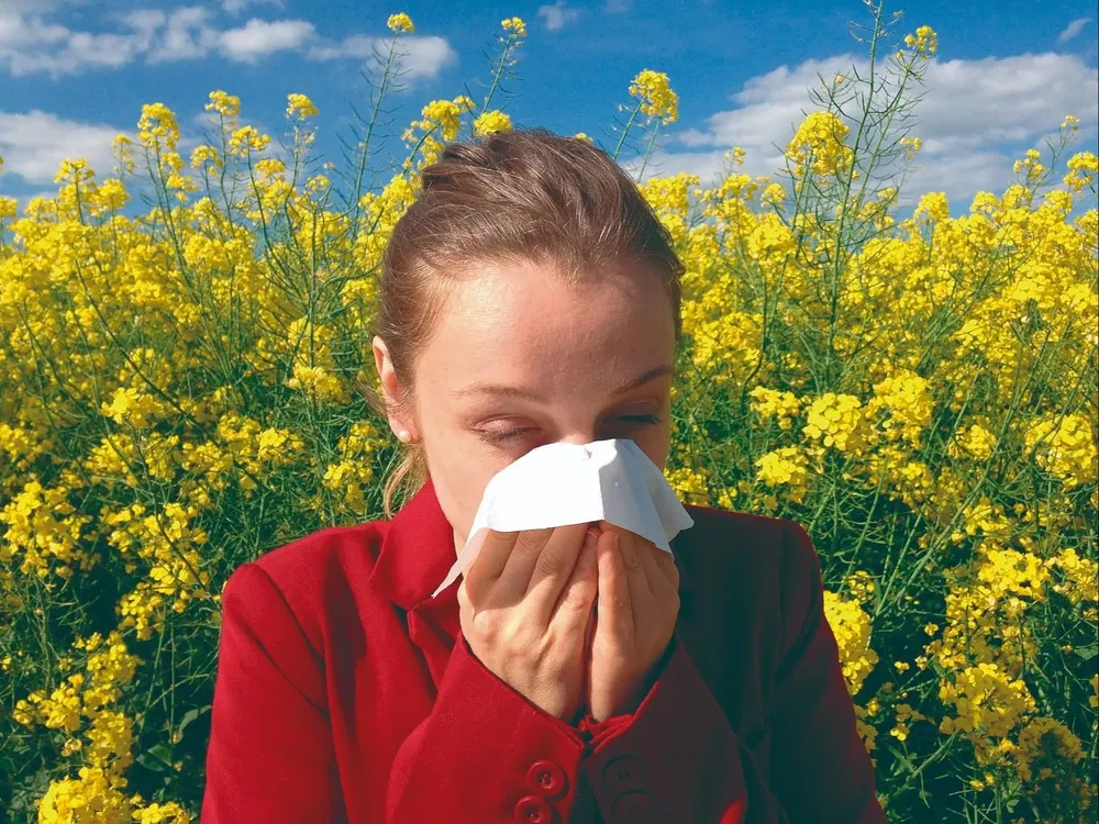 La rinitis es la enfermedad alérgica más frecuente