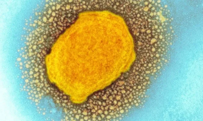 MSP confirma el primer caso de viruela del mono