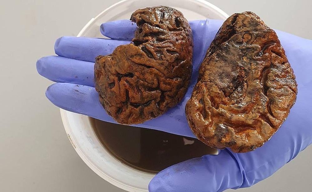 En ausencia de embalsamiento o congelación, el cerebro suele descomponerse rápidamente tras la muerte. Pero algunos perduran en forma espontánea cientos o miles de años.