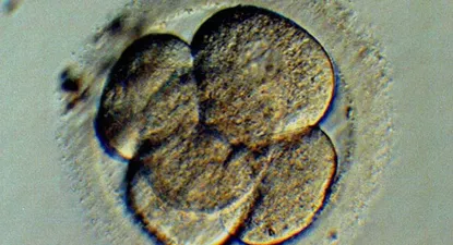 El Observador | 0000475768.webp