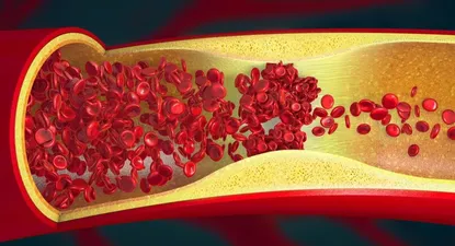La coagulación provocada por el coronavirus podría estar detrás de algunos de los síntomas de covid de larga duraci