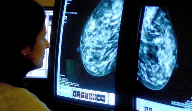 El de mama es uno de los cánceres más comunes en las mujeres.