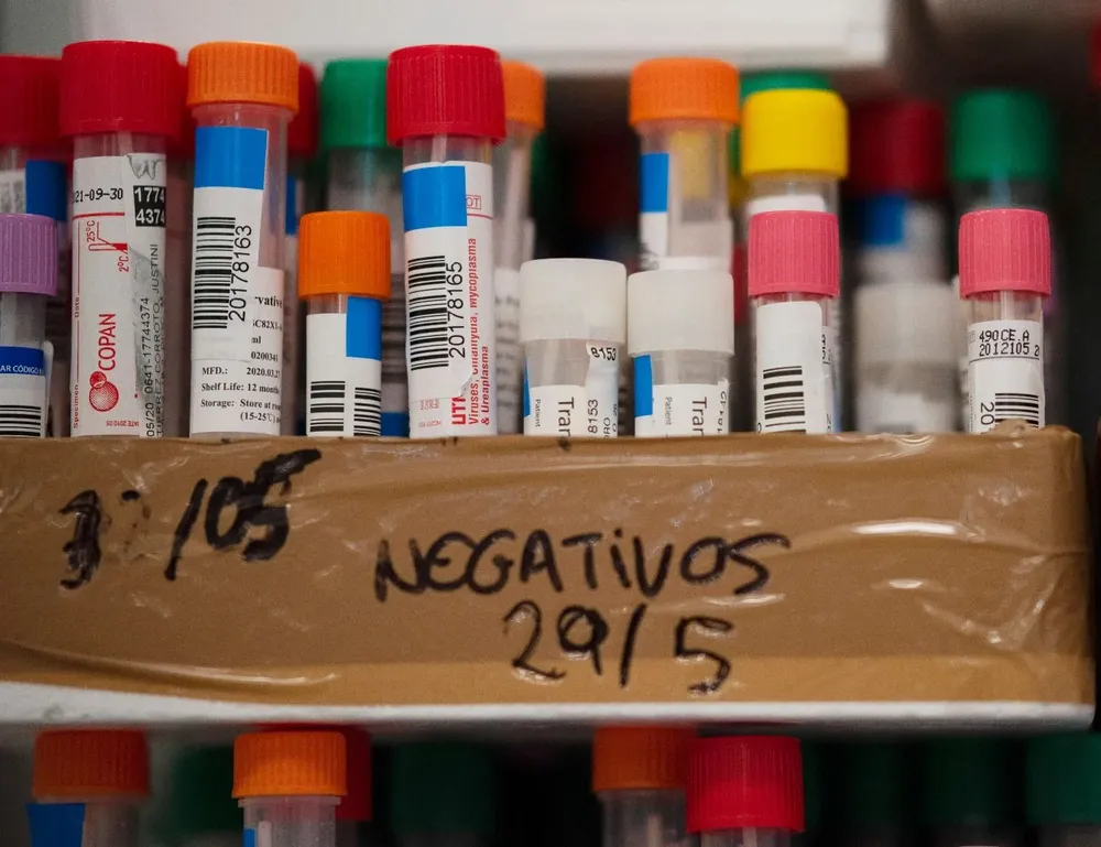 Los informes desguazados y complicaciones logísticas: ¿por qué laboratorios reportan fuera de fecha?