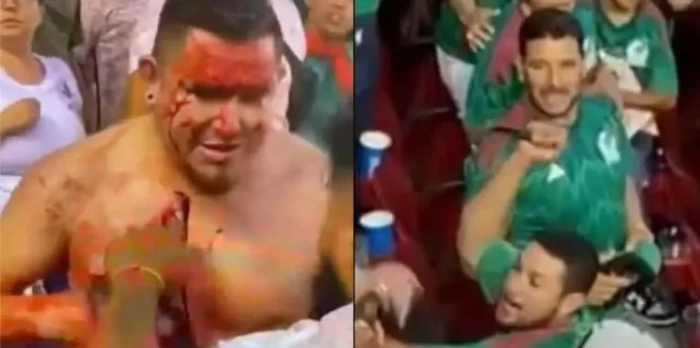 Hincha apuñalado en la tribuna