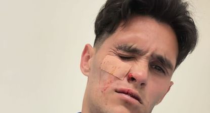 Las impactantes fotos de Ruben Bentancourt tras los cortes que sufrió por un zapataz