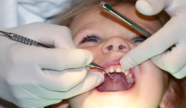 La fluoración del agua ha tenido un impacto particularmente visible en la salud dental de los niños en zonas con dificultad de acceso a crema de dientes con flúor.